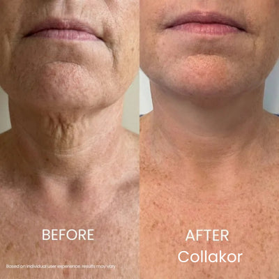 Collakor Tighten & Lift Neck Cream
