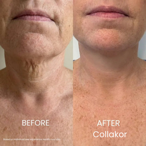 Collakor Tighten & Lift Neck Cream