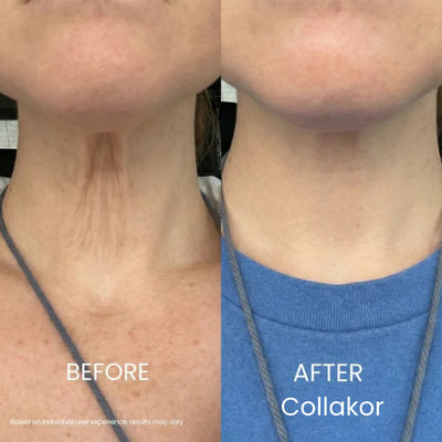 Collakor Tighten & Lift Neck Cream