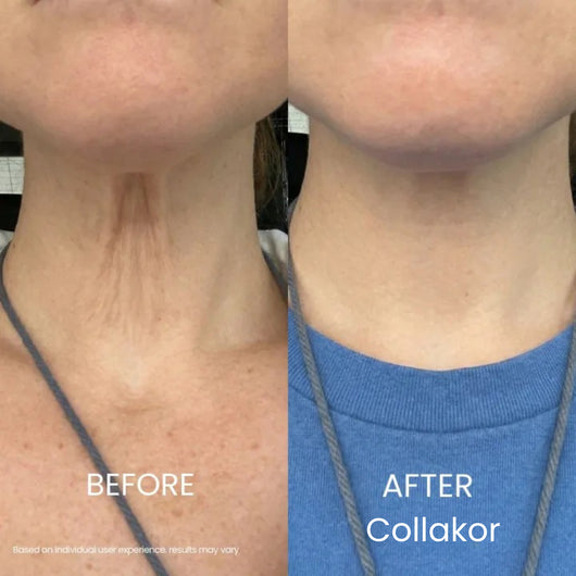 Collakor Tighten & Lift Neck Cream