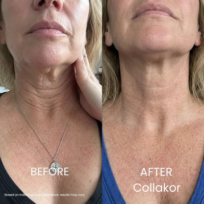 Collakor Tighten & Lift Neck Cream