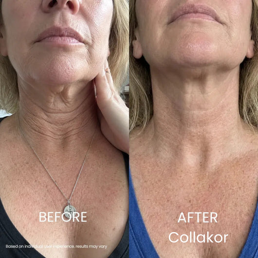 Collakor Tighten & Lift Neck Cream