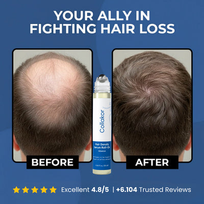 Hair Growth Roll on Serum