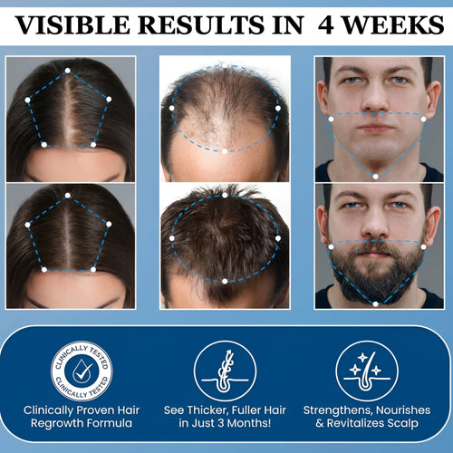 Hair Growth Roll on Serum