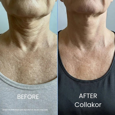 Collakor Tighten & Lift Neck Cream
