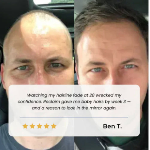 Hair Growth Roll on Serum